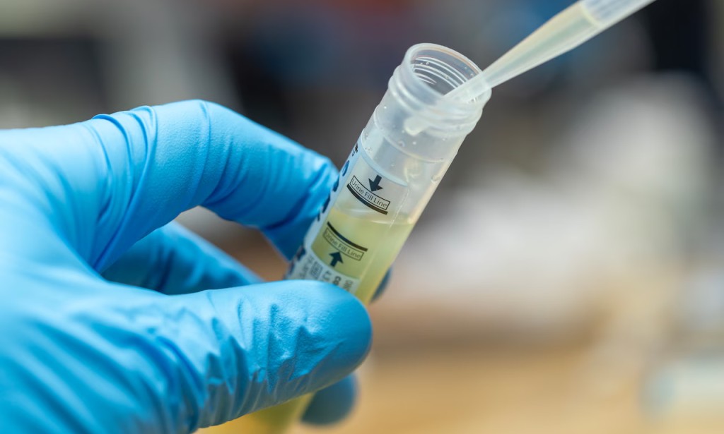 North Carolina's Alarming STD Rates: Why the State Ranks Among the Highest Nationwide